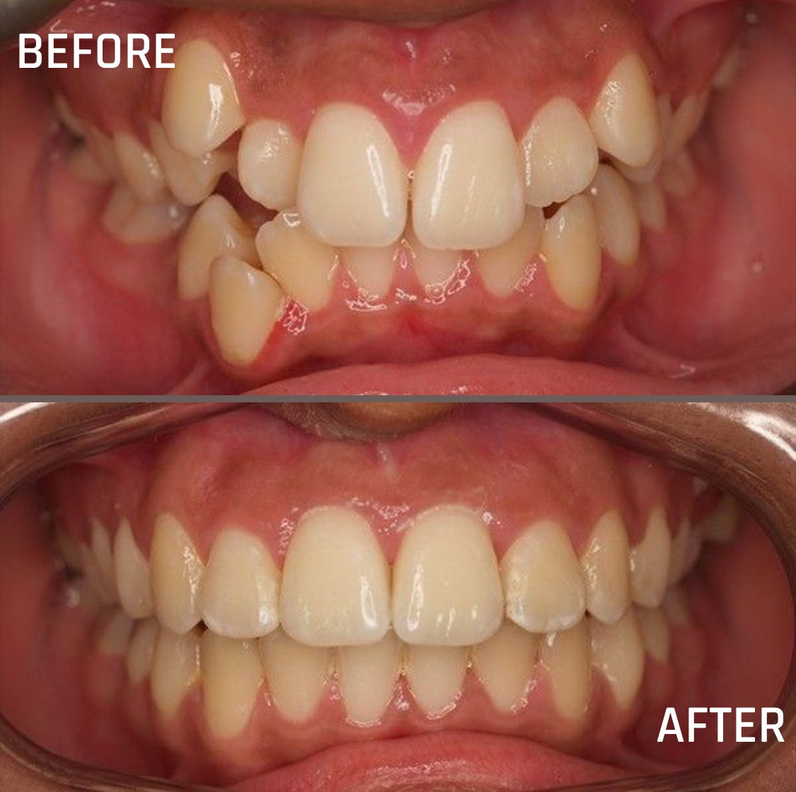 Before & After - Skin Treatment